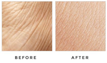 Lumina Luxe before after Results